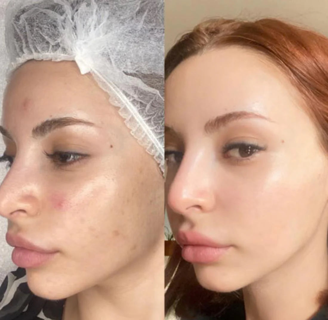 Bio-Kollagen-Gesichtsmasken, Korean Beauty