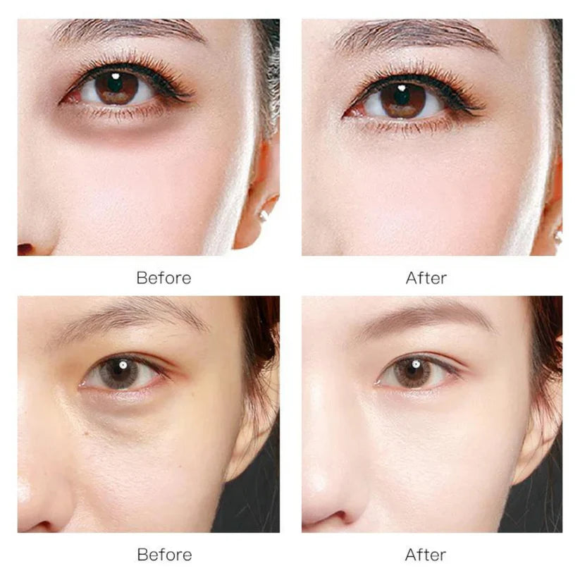 Kollagen Augenmasken, Gold, Korean-Beauty