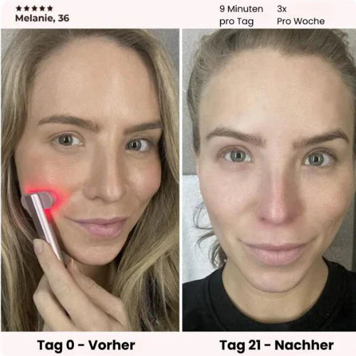EMS-Gesichtsmassagegerät für Hautstraffung und Lifting